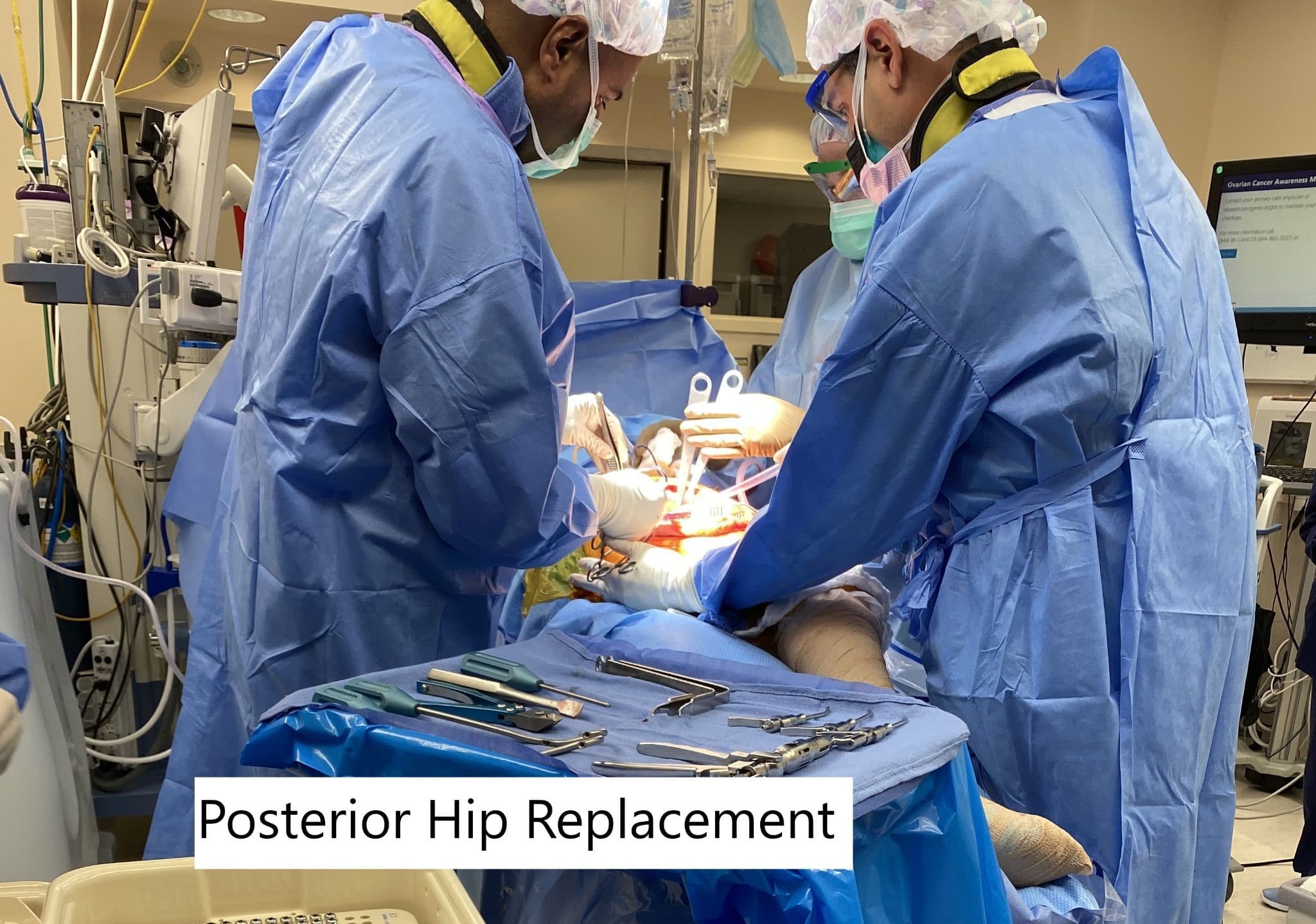 Intraoperative image showing posterior hip replacement. Intraoperative image showing posterior hip replacement.